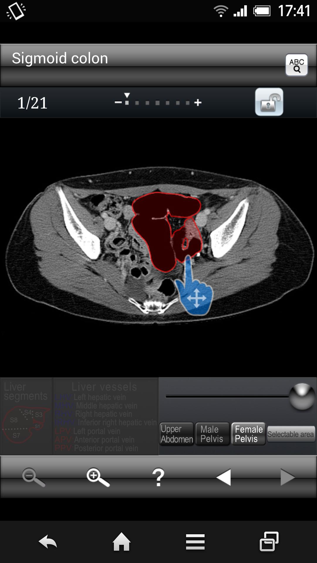 AbdominalCTSectionalWalkerLite
